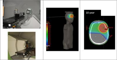 Out-of-Field Doses Produced by a Proton Scanning Beam Inside Pediatric Anthropomorphic Phantoms and Their Comparison With Different Photon Modalities